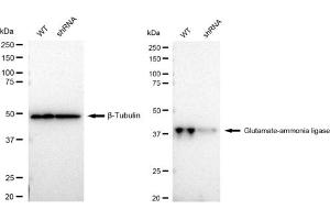 Western blotting analysis using Glutamate-ammonia ligase antibody (ABIN7798741).