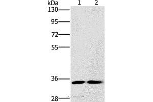 Western blot analysis of A172 and Raji cell, using FAIM2 Polyclonal Antibody at dilution of 1:500 (FAIM2 Antikörper)