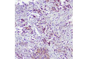 IHC analysis of Caspase-2 using anti-Caspase-2 antibody (ABIN6719550).