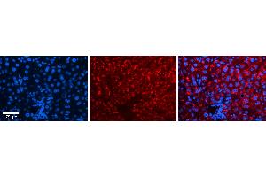 Rabbit Anti-IRF1 Antibody Catalog Number: ARP38129_P050 Formalin Fixed Paraffin Embedded Tissue: Human Liver Tissue Observed Staining: Cytoplasm in hepatocytes Primary Antibody Concentration: N/A Other Working Concentrations: 1:600 Secondary Antibody: Donkey anti-Rabbit-Cy3 Secondary Antibody Concentration: 1:200 Magnification: 20X Exposure Time: 0. (IRF1 Antikörper  (C-Term))