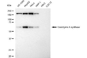 Western blotting analysis using Coenzyme A synthase antibody (ABIN7798104). (Rekombinanter COASY Antikörper)