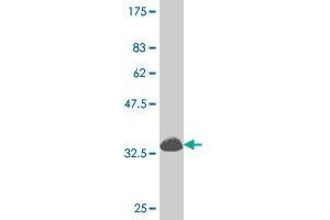 Western Blot detection against Immunogen (34. (DLX1 Antikörper  (AA 181-254))