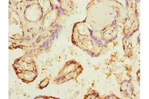 Immunohistochemistry of paraffin-embedded human placenta tissue using ABIN7147657 at dilution of 1:100 (GCM1 Antikörper  (AA 207-436))