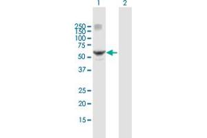 Western Blot analysis of RARG expression in transfected 293T cell line by RARG MaxPab polyclonal antibody.