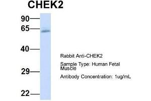 Host:  Rabbit  Target Name:  CHEK2  Sample Type:  Human Fetal Muscle  Antibody Dilution:  1. (CHEK2 Antikörper  (N-Term))