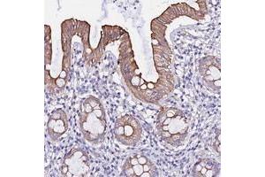 Immunohistochemical staining of human rectum with WDR69 polyclonal antibody  shows moderate cytoplasmic and membranous positivity in glandular cells. (WDR69 Antikörper)