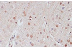 Immunohistochemistry of paraffin-embedded Rat brain using CREB1 Polyclonal Antibody at dilution of 1:100 (40x lens). (CREB1 Antikörper)