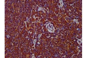 IHC image of ABIN7150062 diluted at 1:400 and staining in paraffin-embedded human lymph node tissue performed on a Leica BondTM system. (ADAM8 Antikörper  (AA 677-824))