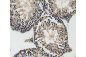 Used in DAB staining on fromalin fixed paraffin- embedded testis tissue (SEMA4D/CD100 Antikörper  (AA 502-636))