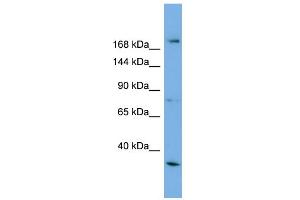 WB Suggested Anti-ALS2 Antibody Titration: 0. (ALS2 Antikörper  (Middle Region))