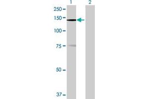 Western Blot analysis of MPHOSPH9 expression in transfected 293T cell line by MPHOSPH9 MaxPab polyclonal antibody. (MPHOSPH9 Antikörper  (AA 1-1031))