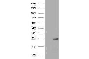 Western Blotting (WB) image for anti-MOB Kinase Activator 1B (MOB1B) antibody (ABIN1499531) (MOBKL1A Antikörper)