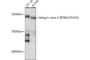 Western blot analysis of extracts of various cell lines, using Integrin beta 4 (ITGB4/CD104) (ITGB4/CD104) Rabbit mAb (ABIN7267931) at 1:1000 dilution. (Integrin beta 4 Antikörper)