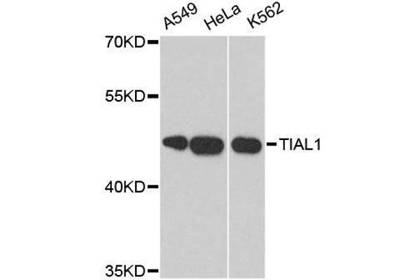 TIAL1 Antikörper  (AA 266-375)
