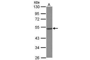 Image no. 1 for anti-Heat Shock Protein 70kDa Family, Member 13 (HSPA13) (AA 204-423) antibody (ABIN1498740) (HSPA13 Antikörper  (AA 204-423))