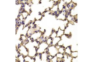 Immunohistochemistry of paraffin-embedded Mouse lung using TPP2 antibody at dilution of 1:100 (x400 lens). (Tpp2 Antikörper)