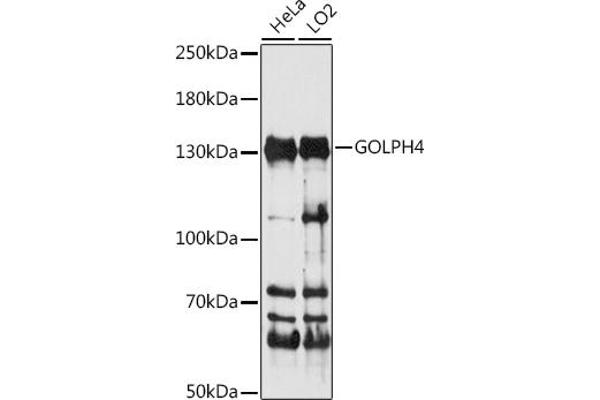 Golgi Integral Membrane Protein 4 (GOLIM4) (AA 34-300) anticorps