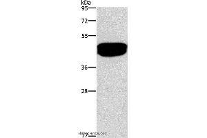 Western blot analysis of Human prostate tissue, using SDCCAG3 Polyclonal Antibody at dilution of 1:500 (SDCCAG3 Antikörper)
