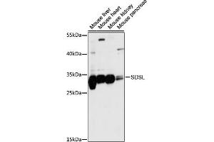 Western blot analysis of extracts of various cell lines, using SDSL antibody (ABIN7270209) at 1:1000 dilution. (SDSL Antikörper  (AA 1-137))