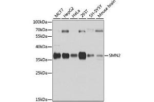 Western blot analysis of extracts of various cell lines, using SMN2 antibody. (SMN2 Antikörper  (AA 1-197))