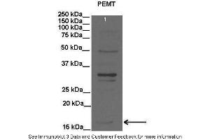 Lanes:   Lane1: 20 ug rat liver lysate  Primary Antibody Dilution:   1:2000  Secondary Antibody:   Anti-rabbit HRP  Secondary Antibody Dilution:   1:15000  Gene Name:   PEMT  Submitted by:   Anonymous (PEMT Antikörper  (C-Term))