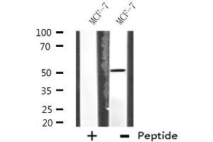 Western blot analysis of extracts from MCF-7 cells, using HUCE1 antibody. (RRP8 Antikörper  (Internal Region))