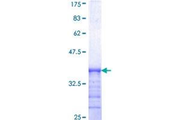 SDCBP Protein (AA 1-100) (GST tag)