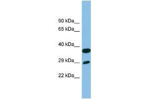 WB Suggested Anti-RTP4 Antibody Titration: 0.