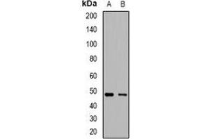 Western blot analysis of IgM expression in HepG2 (A), Raji (B) whole cell lysates. (Kaninchen anti-Human IgM (C-Term) Antikörper)