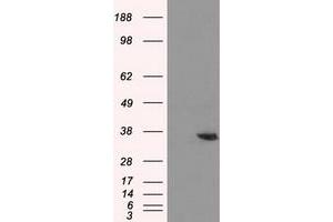 Western Blotting (WB) image for anti-Aldo-Keto Reductase Family 1, Member A1 (Aldehyde Reductase) (AKR1A1) antibody (ABIN1496539) (AKR1A1 Antikörper)