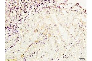 Formalin-fixed and paraffin embedded dog bladder tissue labeled with Anti-NSE/ENO2/γ Enolase Polyclonal Antibody, Unconjugated  at 1:800, followed by conjugation to the secondary antibody and DAB staining (ENO2/NSE Antikörper  (AA 201-300))