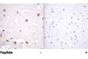 Immunohistochemical analysis of paraffin-embedded human brain tissue using CSNK2B polyclonal antibody .