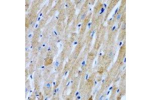 Immunohistochemical analysis of GlyRS staining in rat heart formalin fixed paraffin embedded tissue section. (GlyRS Antikörper)
