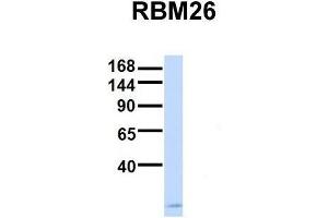Host:  Rabbit  Target Name:  RBM26  Sample Type:  Human Fetal Brain  Antibody Dilution:  1. (RBM26 Antikörper  (Middle Region))