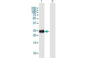 Western Blot analysis of INS-IGF2 expression in transfected 293T cell line by INS-IGF2 MaxPab polyclonal antibody. (INS-IGF2 Antikörper  (AA 1-200))