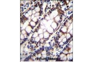 Immunohistochemistry (Paraffin-embedded Sections) (IHC (p)) image for anti-Ubiquinol-Cytochrome C Reductase, Rieske Iron-Sulfur Polypeptide 1 (UQCRFS1) (AA 181-209), (C-Term) antibody (ABIN655606)