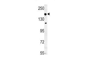 IF Antibody (N-term) (ABIN651581 and ABIN2840310) western blot analysis in mouse lung tissue lysates (35 μg/lane). (IFT172 Antikörper  (N-Term))