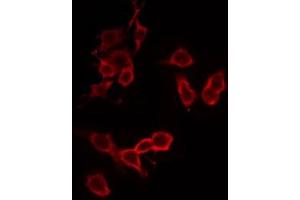 ABIN6274875 staining HeLa by IF/ICC. (ATP5C1 Antikörper  (Internal Region))