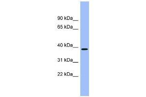 ACMSD antibody used at 1 ug/ml to detect target protein.