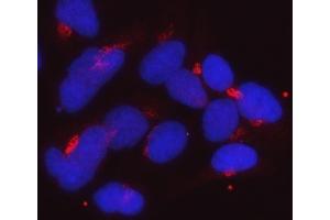 IF analysis of Golgin 97/GOLGA1 using anti-Golgin 97/GOLGA1 antibody (ABIN7599538). (GOLGA1 Antikörper  (AA 1-752))