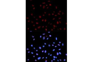 Immunofluorescence analysis of U2OS cells using Phospho-MET-Y1235 antibody (ABIN5969924). (c-MET Antikörper  (pTyr1235))
