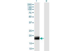 Western Blot analysis of 2-Mar expression in transfected 293T cell line by MARCH2 monoclonal antibody (M04), clone 7F3. (MARCH2 Antikörper  (AA 1-176))
