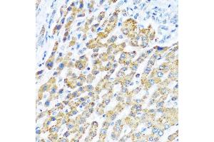 Immunohistochemistry (Paraffin-embedded Sections) (IHC (p)) image for anti-Leucine-Rich PPR-Motif Containing (LRPPRC) (AA 1041-1394) antibody (ABIN1680717)
