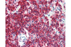Anti-CD45RA antibody IHC of human spleen. (CD45RA Antikörper  (FITC))