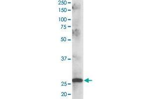 CLPP polyclonal antibody  staining (1 ug/mL) of human muscle lysate (RIPA buffer, 35 ug total protein per lane). (CLPP Antikörper)