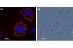 Expression of KCNK18 in ND7/23 cell line - Cell surface detection of KCNK18 in living mouse/rat neuroblastoma x dorsal root ganglion neuron hybrid cell line (ND7/23). (KCNK18 Antikörper  (Extracellular))
