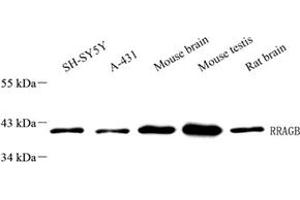 Western blot analysis of RRAGB (ABIN7075379),at dilution of 1: 1000