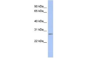 WB Suggested Anti-C14orf166 Antibody Titration:  0. (C14orf166 Antikörper  (Middle Region))