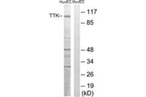 Western blot analysis of extracts from HuvEc cells, treated with etoposide 25uM 24H, using TTK (Ab-676) Antibody. (Mps1 Antikörper  (AA 642-691))