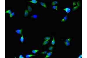 Immunofluorescent analysis of Hela cells using ABIN7148328 at dilution of 1:100 and Alexa Fluor 488-congugated AffiniPure Goat Anti-Rabbit IgG(H+L) (C1QTNF9B Antikörper  (AA 2-192))